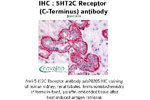 Image no. 1 for anti-5-Hydroxytryptamine (serotonin) Receptor 2C (HTR2C) (C-Term) antibody (ABIN1731369) (HTR2C anticorps  (C-Term))