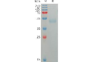 SIRPG Protein (AA 29-364) (His tag)
