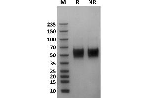 Human Fc gamma RIIIa / CD16a (176F) protein on Coomassie Blue stained SDS-PAGE under non-reducing (NR) and reducing (R) conditions. (FCGR3A Protein (AA 17-208) (His-Avi Tag,Biotin))