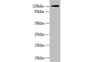 Western blot All lanes: SLC4A8 antibody at 2 μg/mL + Hela whole cell lysate Secondary Goat polyclonal to rabbit IgG at 1/10000 dilution Predicted band size: 123, 121, 118, 112, 78, 84, 72 kDa Observed band size: 123 kDa (SLC4A8 anticorps  (AA 1-300))