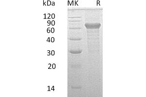 IL20RB Protein (Fc Tag)