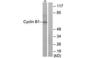 Western blot analysis of extracts from Jurkat cells, treated with UV 15', using Cyclin B1 (Ab-147) Antibody. (Cyclin B1 anticorps  (AA 121-170))