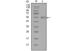 Western Blot showing SYT1 antibody used against truncated Trx-SYT1 recombinant protein (1). (SYT1 anticorps)
