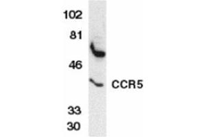 Image no. 2 for anti-Chemokine (C-C Motif) Receptor 5 (CCR5) (AA 6-20) antibody (ABIN319017) (CCR5 anticorps  (AA 6-20))
