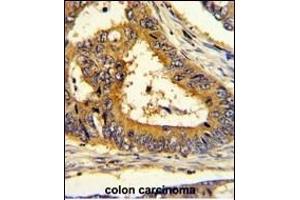 Immunohistochemistry (Paraffin-embedded Sections) (IHC (p)) image for anti-SREBF chaperone (SCAP) (AA 604-632) antibody (ABIN652508)