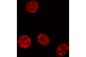 ABIN6267674 staining HepG2 by IF/ICC. (PDCD4 anticorps  (pSer457))