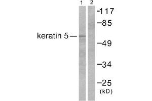 Western Blotting (WB) image for anti-Keratin 5 (KRT5) (C-Term) antibody (ABIN1848638) (Cytokeratin 5 anticorps  (C-Term))