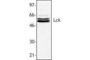 Western Blotting (WB) image for anti-Lymphocyte-Specific Protein tyrosine Kinase (LCK) antibody (ABIN2665225) (LCK anticorps)