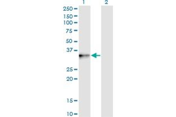 PIH1D1 anticorps  (AA 1-290)