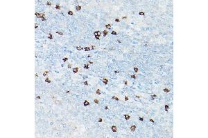 Immunohistochemistry of paraffin-embedded human tonsil using CD8A Rabbit mAb (ABIN1512846, ABIN3021030, ABIN3021031 and ABIN7101333) at dilution of 1:100 (40x lens). (CD8 alpha anticorps)