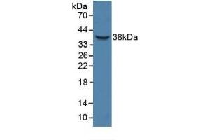 Detection of Recombinant HPR, Human using Polyclonal Antibody to Haptoglobin Related Protein (HPR) (HPR anticorps  (AA 70-332))