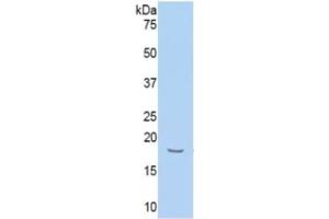 Western Blotting (WB) image for Hemopexin (HPX) ELISA Kit (ABIN6730956)