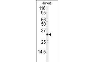 Western blot analysis of anti-JUND Antibody (S255) in Jurkat cell line lysates (35ug/lane) (JunD anticorps  (AA 233-262))