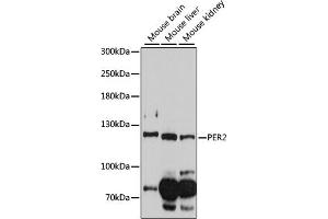 Western blot analysis of extracts of various cell lines, using PER2 antibody (ABIN6134741, ABIN6145451, ABIN6145453 and ABIN6218314) at 1:1000 dilution. (PER2 anticorps  (AA 1-100))
