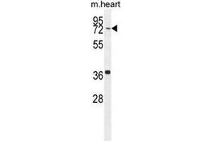 CCDC38 Antibody (Center) western blot analysis in mouse heart tissue lysates (35µg/lane). (CCDC38 anticorps  (Middle Region))