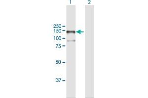 Lane 1: MAP3K13 transfected lysate ( 106. (MAP3K13 293T Cell Transient Overexpression Lysate(Denatured))