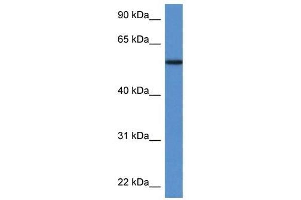 Phosphoglucomutase 5 anticorps  (N-Term)