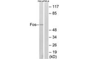 Western blot analysis of extracts from HeLa cells, using Fos (Ab-374) Antibody. (c-FOS anticorps  (AA 331-380))