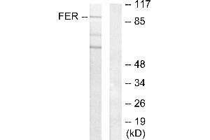 Western blot analysis of extracts from HeLa cells, using FER antibody. (FER anticorps)