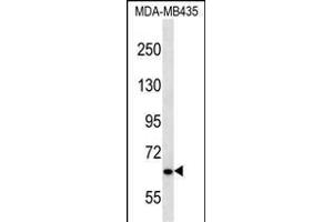 NPHP3 Antibody (N-term) (ABIN656679 and ABIN2845918) western blot analysis in MDA-M cell line lysates (35 μg/lane). (NPHP3 anticorps  (N-Term))
