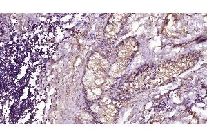 Immunohistochemistry (Paraffin-embedded Sections) (IHC (p)) image for anti-CD28 (CD28) (AA 1-120) antibody (ABIN674604)