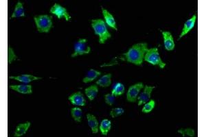 Immunofluorescence staining of SH-SY5Y cells with ABIN7140143 at 1:50, counter-stained with DAPI. (CD24 anticorps  (AA 28-46))