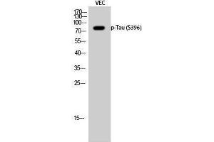 Western Blotting (WB) image for anti-tau Protein (pSer396) antibody (ABIN3182162) (tau anticorps  (pSer396))