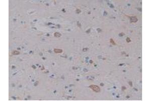 IHC-P analysis of Human Brain Tissue, with DAB staining. (NPY anticorps  (AA 30-97))