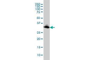 Western Blotting (WB) image for anti-Emerin (EMD) (AA 1-111) antibody (ABIN598659) (Emerin anticorps  (AA 1-111))