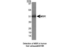 Image no. 1 for anti-Macrophage Scavenger Receptor 1 (MSR1) (AA 300-350) antibody (ABIN363495) (Macrophage Scavenger Receptor 1 anticorps  (AA 300-350))