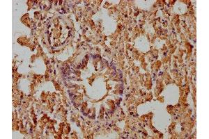 IHC image of ABIN7176993 diluted at 1:400 and staining in paraffin-embedded mouse lung tissue performed on a Leica BondTM system. (beta-2 Microglobulin anticorps  (AA 21-119))