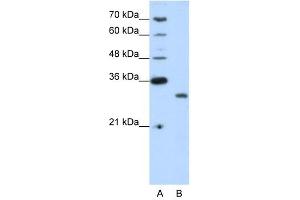 CPXCR1 antibody (20R-1231) used at 0. (CPXCR1 anticorps  (N-Term))