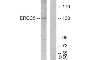 Western Blotting (WB) image for anti-DNA Repair Protein Complementing XP-G Cells (ERCC5) (N-Term) antibody (ABIN1849293) (ERCC5 anticorps  (N-Term))