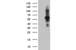 HEK293T cells were transfected with the pCMV6-ENTRY control (Left lane) or pCMV6-ENTRY PDLIM5 (Right lane) cDNA for 48 hrs and lysed. (PDLIM5 anticorps)