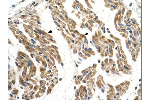 SLC35F2 anticorps  (N-Term)