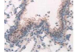 Detection of MAPK7 in Mouse Lung Tissue using Polyclonal Antibody to Mitogen Activated Protein Kinase 7 (MAPK7) (MAPK7 anticorps  (AA 185-419))