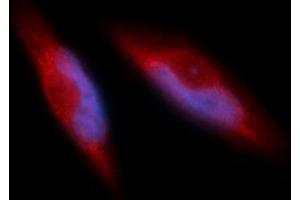 Immunofluorescence (IF) image for anti-Integrin beta 1 (ITGB1) (AA 21-461) antibody (PE) (ABIN5566385) (ITGB1 anticorps  (AA 21-461) (PE))