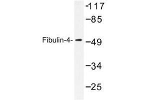 Image no. 1 for anti-Fibulin 4 (FBLN4) antibody (ABIN317833) (FBLN4 anticorps)