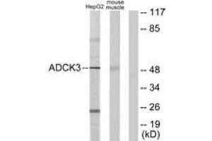 Western Blotting (WB) image for anti-Coenzyme Q8A (COQ8A) (AA 301-350) antibody (ABIN2889684) (COQ8A anticorps  (AA 301-350))