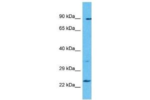 Host: Rabbit Target Name: TBC1D28 Sample Type: Uterus Tumor lysates Antibody Dilution: 1. (TBC1D28 anticorps  (Middle Region))