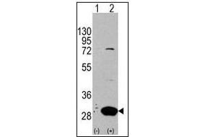 Western blot analysis of Latexin (arrow) in 293 cell lysates (2 µg/lane) either nontransfected (Lane 1) or transiently transfected with the LXN gene (Lane 2) (Latexin anticorps  (Center))