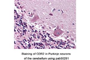 Image no. 1 for anti-Cerebellar Degeneration-Related Protein 2, 62kDa (CDR2) (C-Term) antibody (ABIN363590) (CDR2 anticorps  (C-Term))