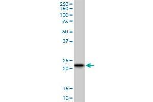 Western Blotting (WB) image for anti-RAB7B, Member RAS Oncogene Family (RAB7B) (AA 100-199) antibody (ABIN567027)