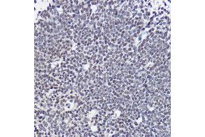 Immunohistochemistry of paraffin-embedded mouse embryos using SOX1 Rabbit pAb (ABIN3017344, ABIN3017345, ABIN3017346 and ABIN1682856) at dilution of 1:25 (40x lens). (SOX1 anticorps)