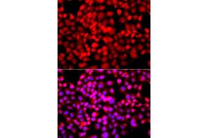 Immunofluorescence analysis of A549 cells using TDP1 antibody (ABIN5975735). (TDP1 anticorps)