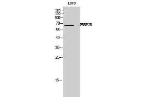 Western Blotting (WB) image for anti-PWWP Domain Containing 2B (PWWP2B) (Internal Region) antibody (ABIN6282515) (PWWP2B anticorps  (Internal Region))