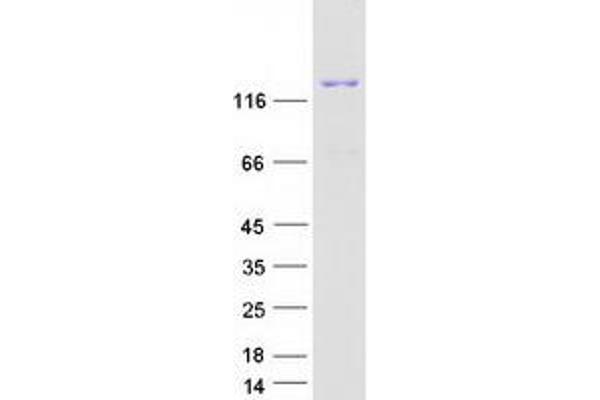 AGL Protein (Transcript Variant 1) (Myc-DYKDDDDK Tag)