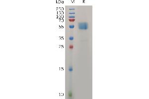 Human TM Protein, hFc Tag on SDS-PAGE under reducing condition. (TMIGD2 Protein (AA 23-150) (Fc Tag))