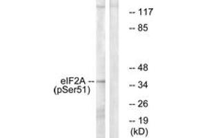 Western Blotting (WB) image for anti-Eukaryotic Translation Initiation Factor 2 Subunit 1 (EIF2S1) (pSer51) antibody (ABIN2888402) (EIF2S1 anticorps  (pSer51))