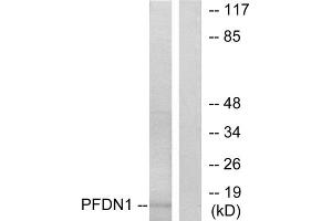 Western blot analysis of extracts from RAW264. (PFDN1 anticorps  (N-Term))